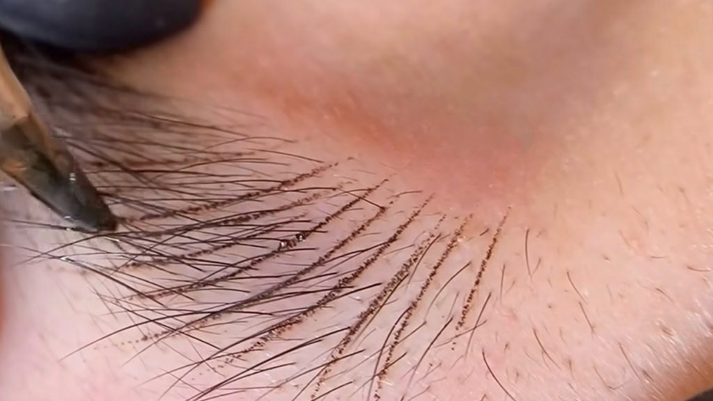 Nano Brows procedure at Dermaluxe Spa in Houston, TX - Dermaluxe Spa Houston TX - Book Your Appointment for Nano Brows at Dermaluxe Spa in Houston Today